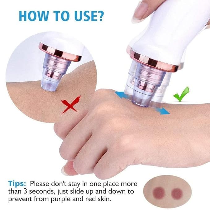 Primepick Blackhead Whitehead Extractor Remover