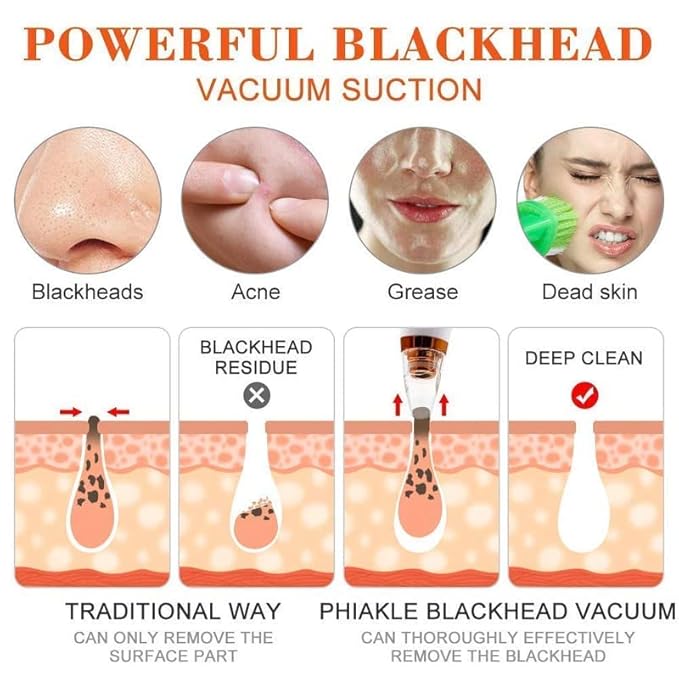 Primepick Blackhead Whitehead Extractor Remover